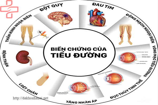 benh-tieu-duong-dai-thao-duong-la-gi