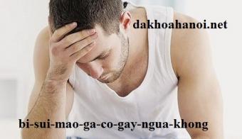 bi-sui-mao-ga-co-gay-ngua-khong